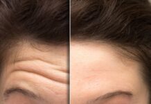 Botox Forehead Before and After | See Real Results & Smoother Skin Botox Forehead Before and After | See Real Results & Smoother Skin
